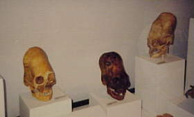 Deformierte Schädel